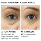 EYEUNDER™ Dark Circles & Bag Eye Cream