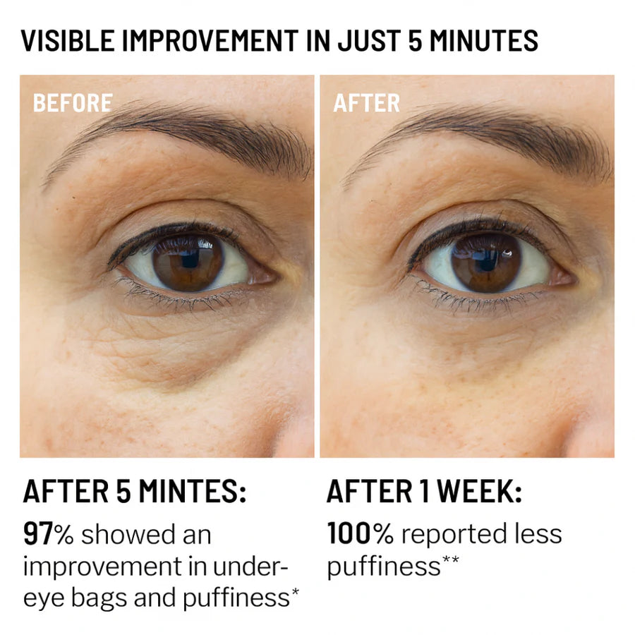 EYEUNDER™ Dark Circles & Bag Eye Cream