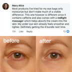 EYEUNDER™ Dark Circles & Bag Eye Cream