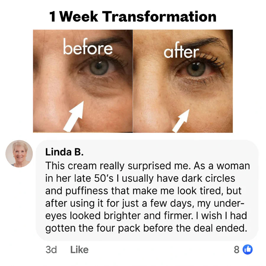 EYEUNDER™ Dark Circles & Bag Eye Cream