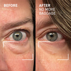 EYEUNDER™ Dark Circles & Bag Eye Cream