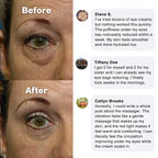 EYEUNDER™ Dark Circles & Bag Eye Cream
