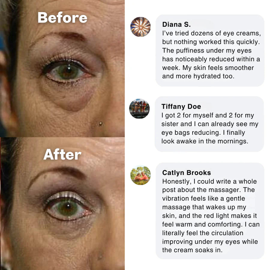 EYEUNDER™ Dark Circles & Bag Eye Cream